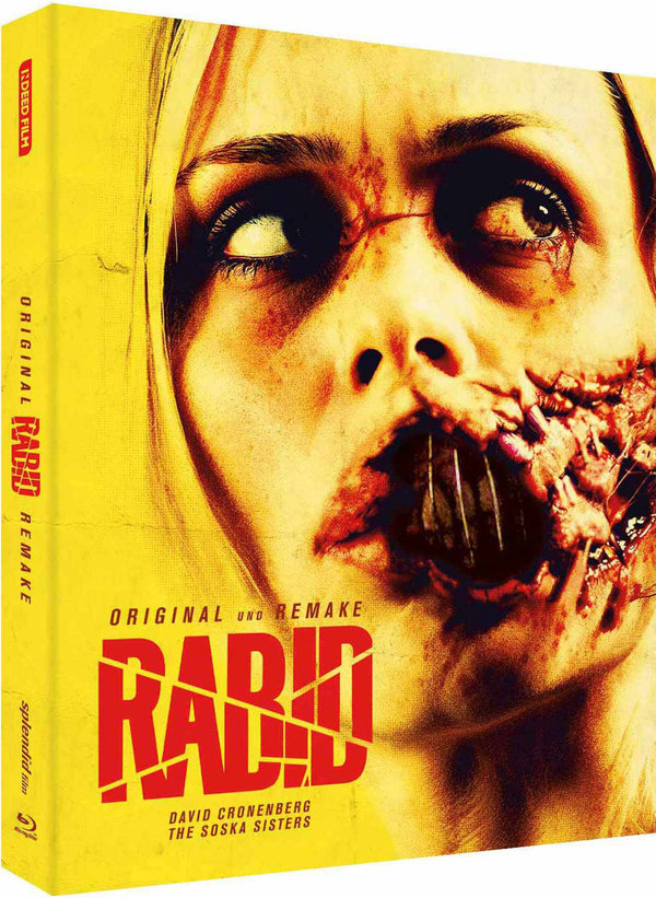 Rabid - 2-Disc Limited Edition (Original + Remake)  (Blu-ray Disc)